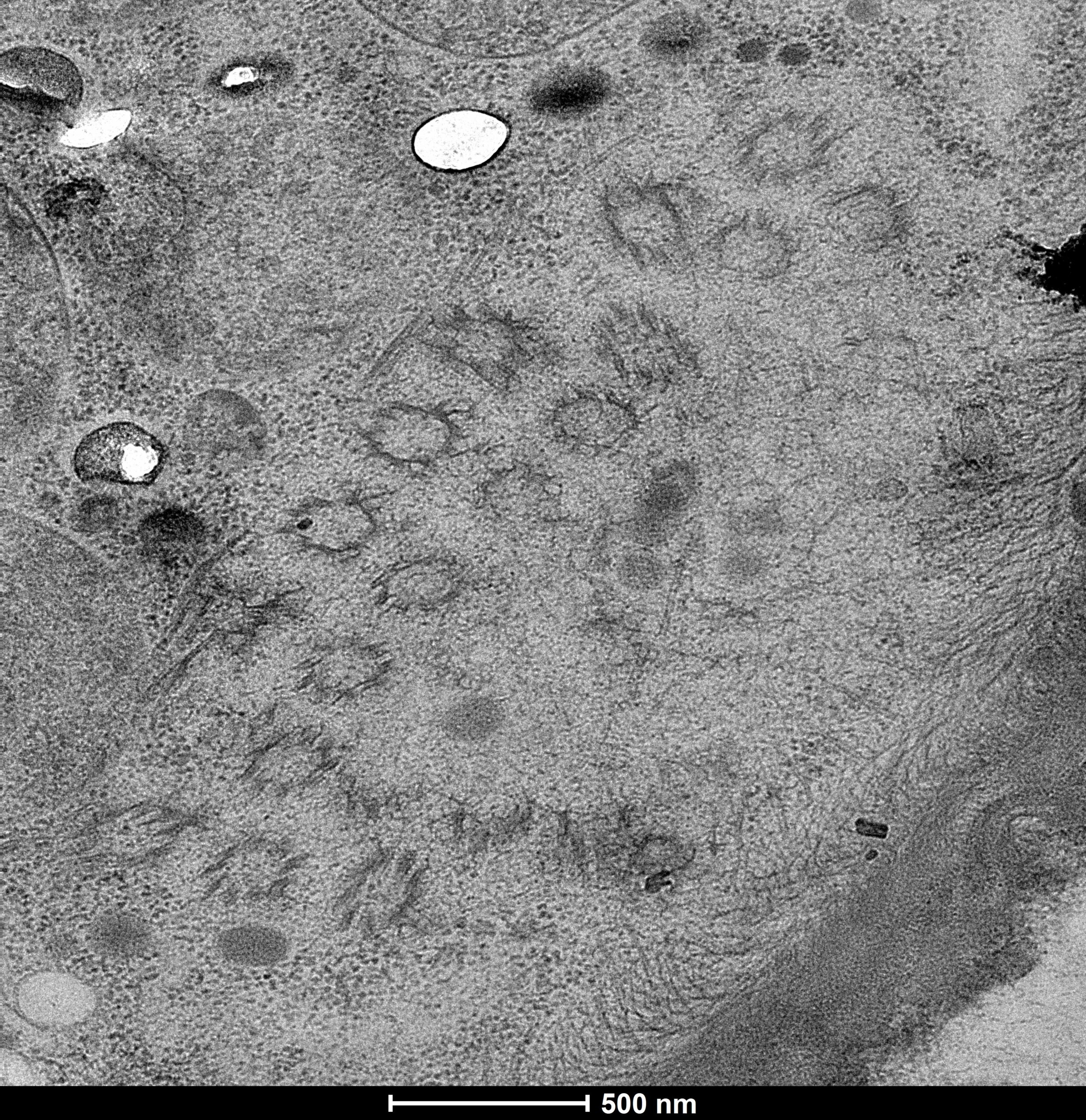 Tubule structures in a resin embedded Podophrya collini cell. 