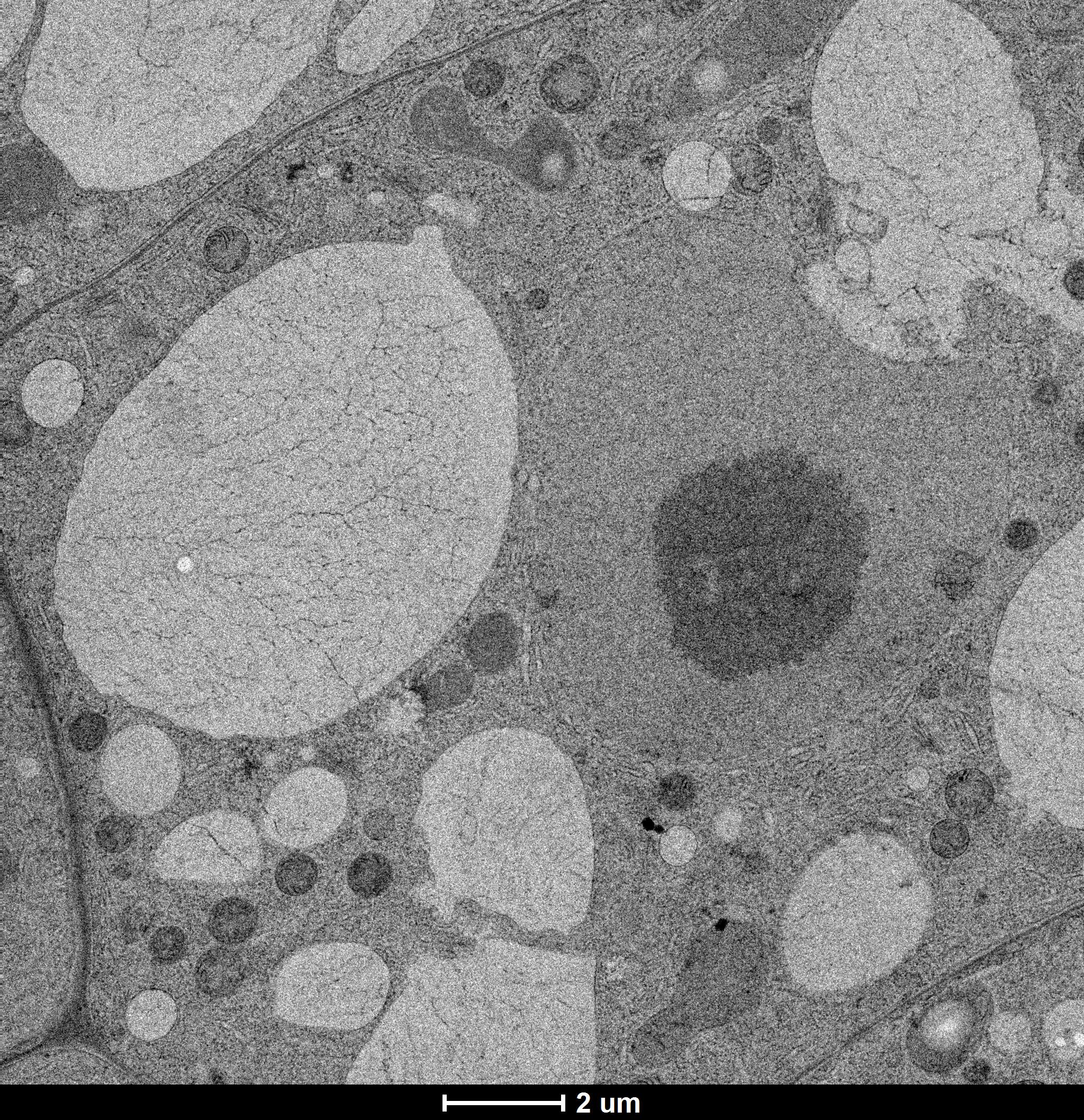 Cell in an arabidopsis root. 